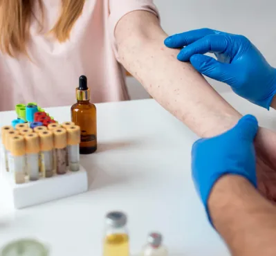 Diagnósticos em Alergia e Imunologia