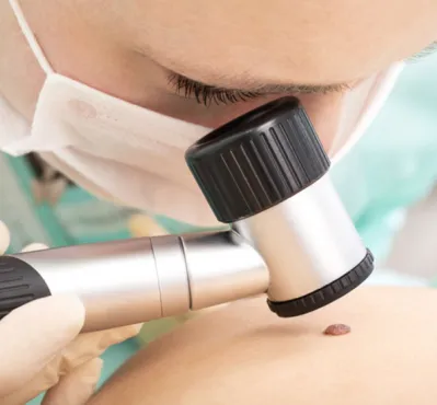 Procedimentos Dermatológicos